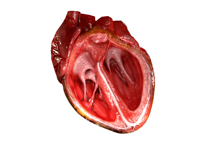 Beating heart with the ventricles shown open.