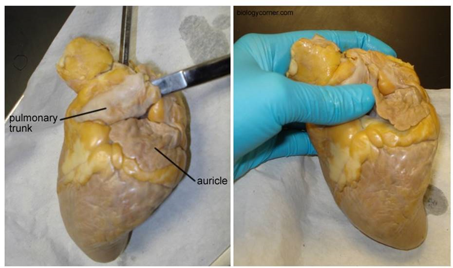images of heart dissection 