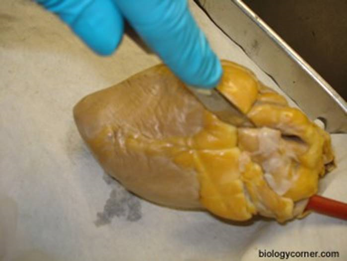 image of heart dissection 