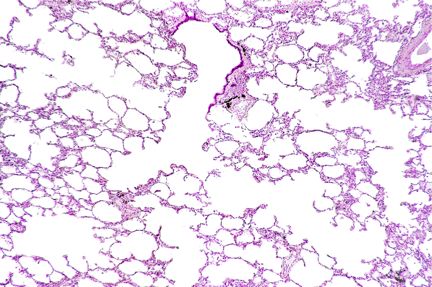 Microscopic image of lung tissue for labeling