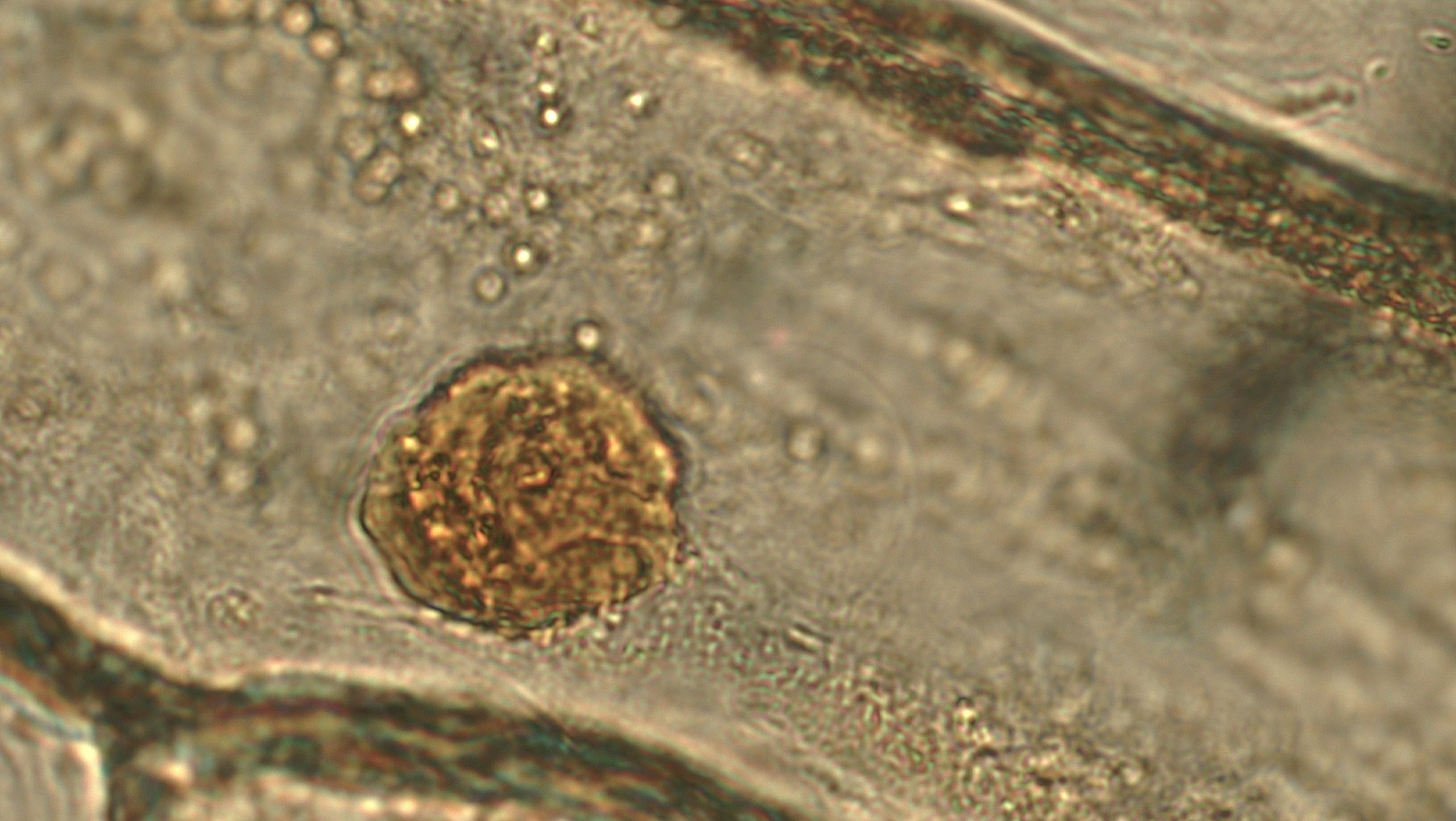 A boxy onion cell with no visible components except a large, globose nucleus