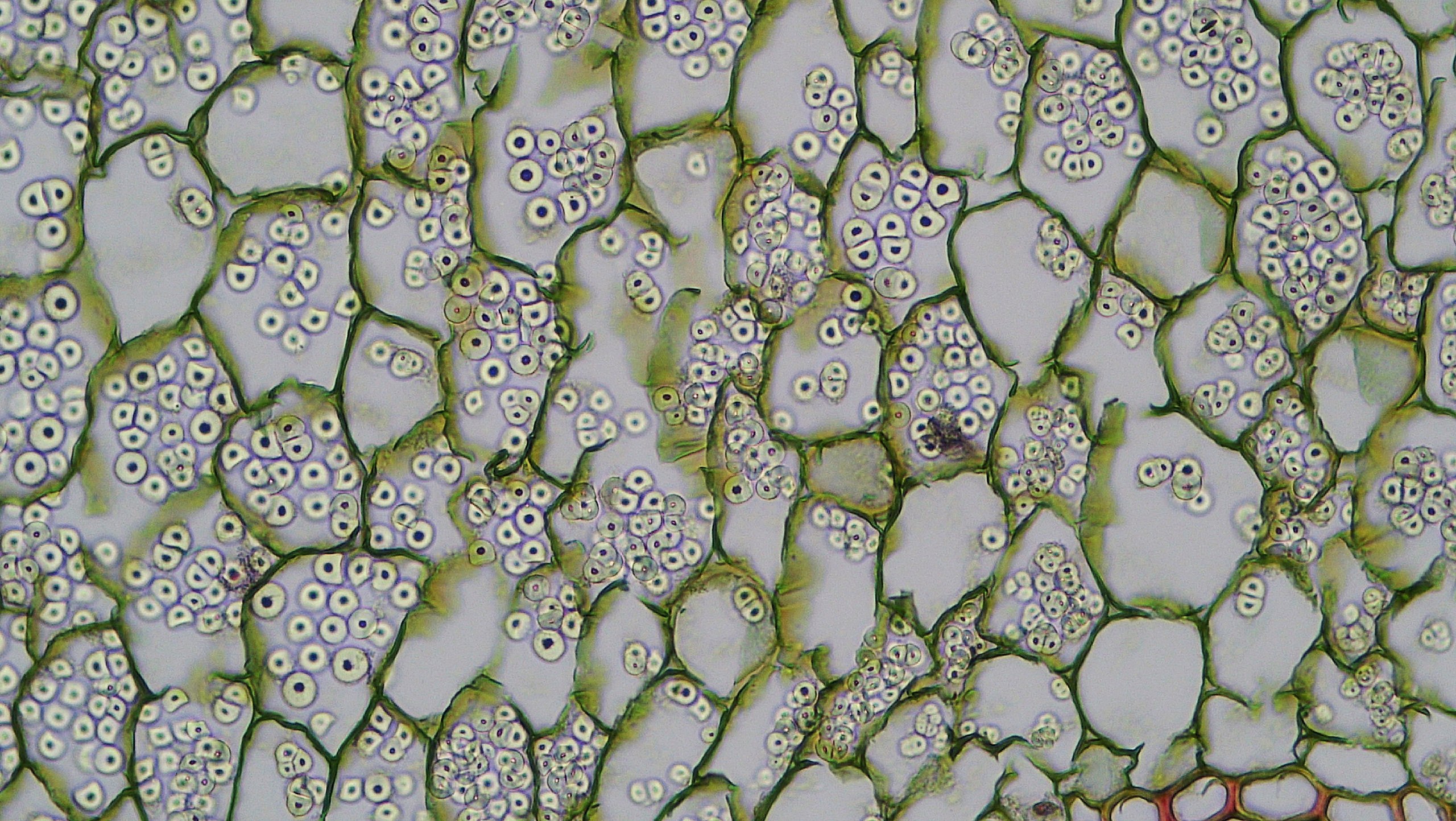 Muchas células se empaquetan estrechamente junto con paredes celulares delgadas. Las celdas contienen estructuras redondas.