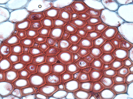 Un denso grupo de células con paredes celulares uniformemente gruesas que se han teñido de rojo oscuro