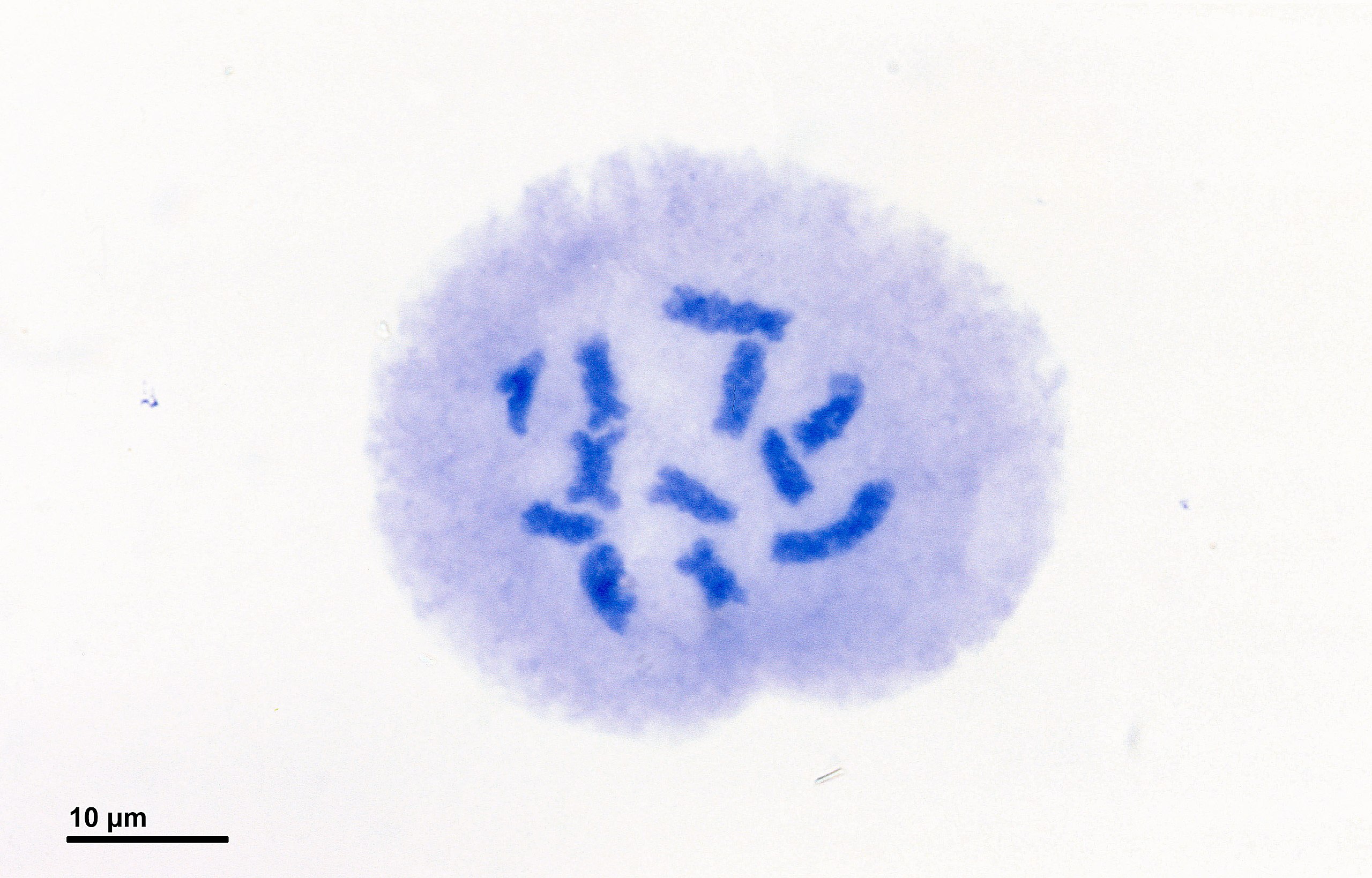 Una sola célula madre de polen con cromosomas condensados visibles, sin envoltura nuclear ni nucleolo.