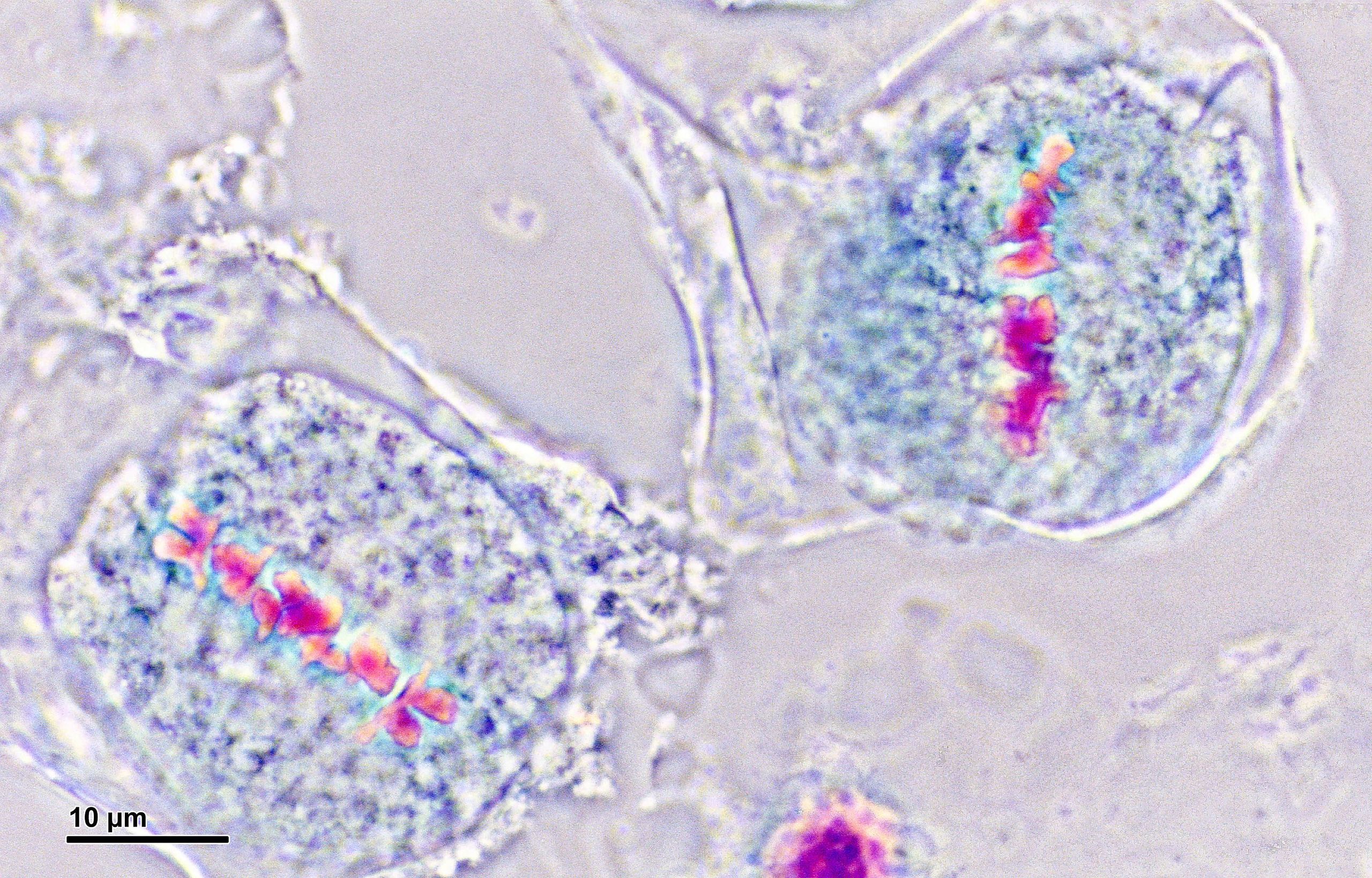 Two cells with bright neon pink chromosomes in a tight line across the center of the cell.