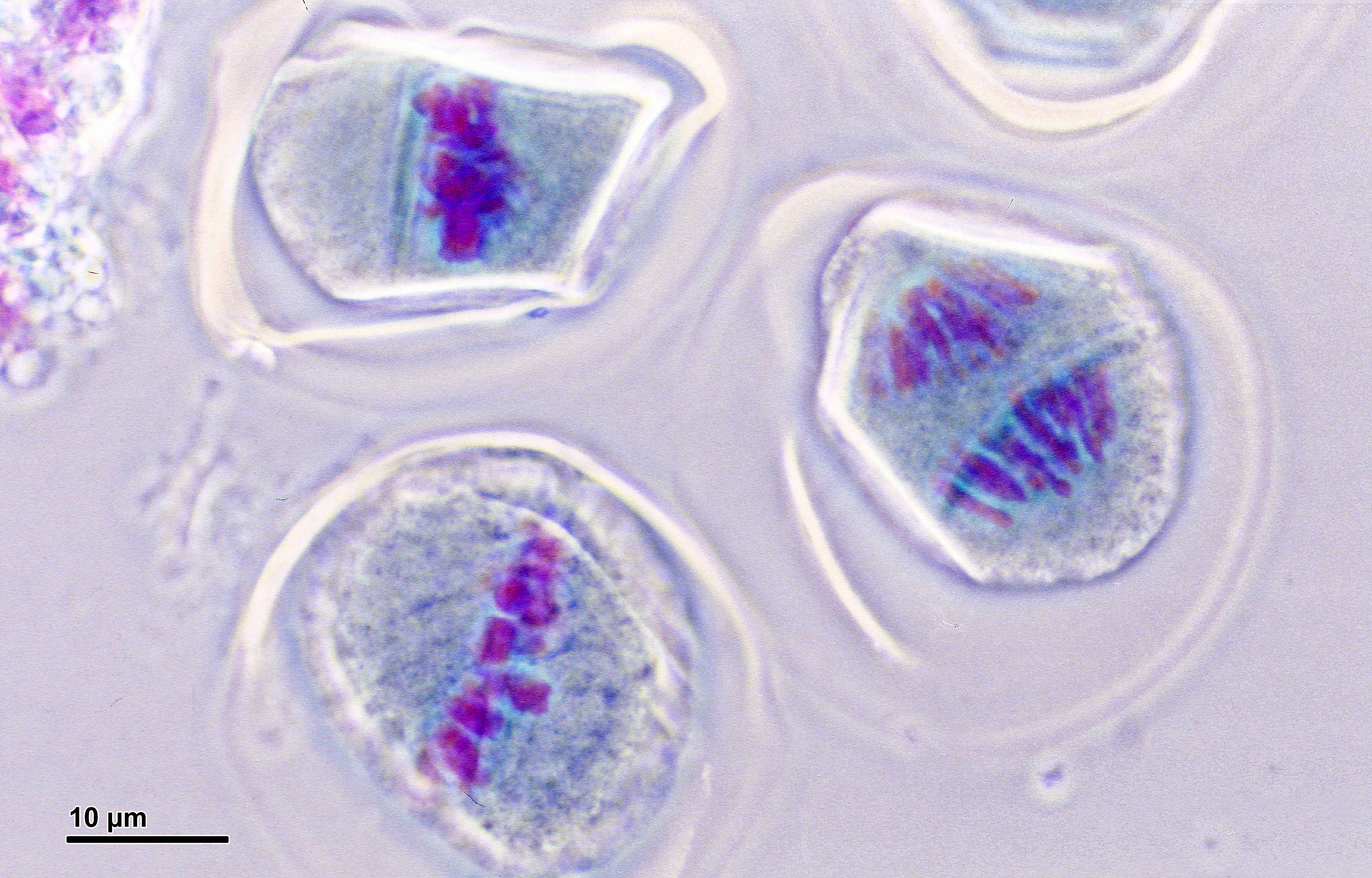 Three pollen mother cells in stages of meiosis