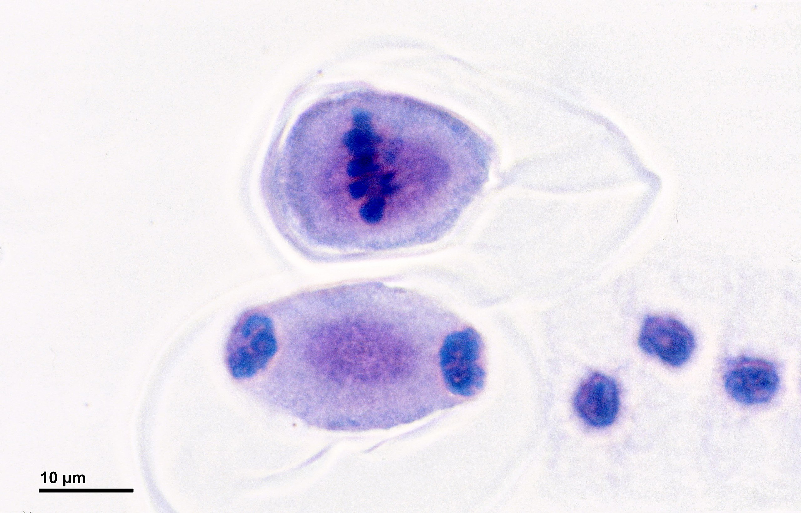 Células con cromosomas en línea o condensadas en dos bolas apretadas en cada extremo.
