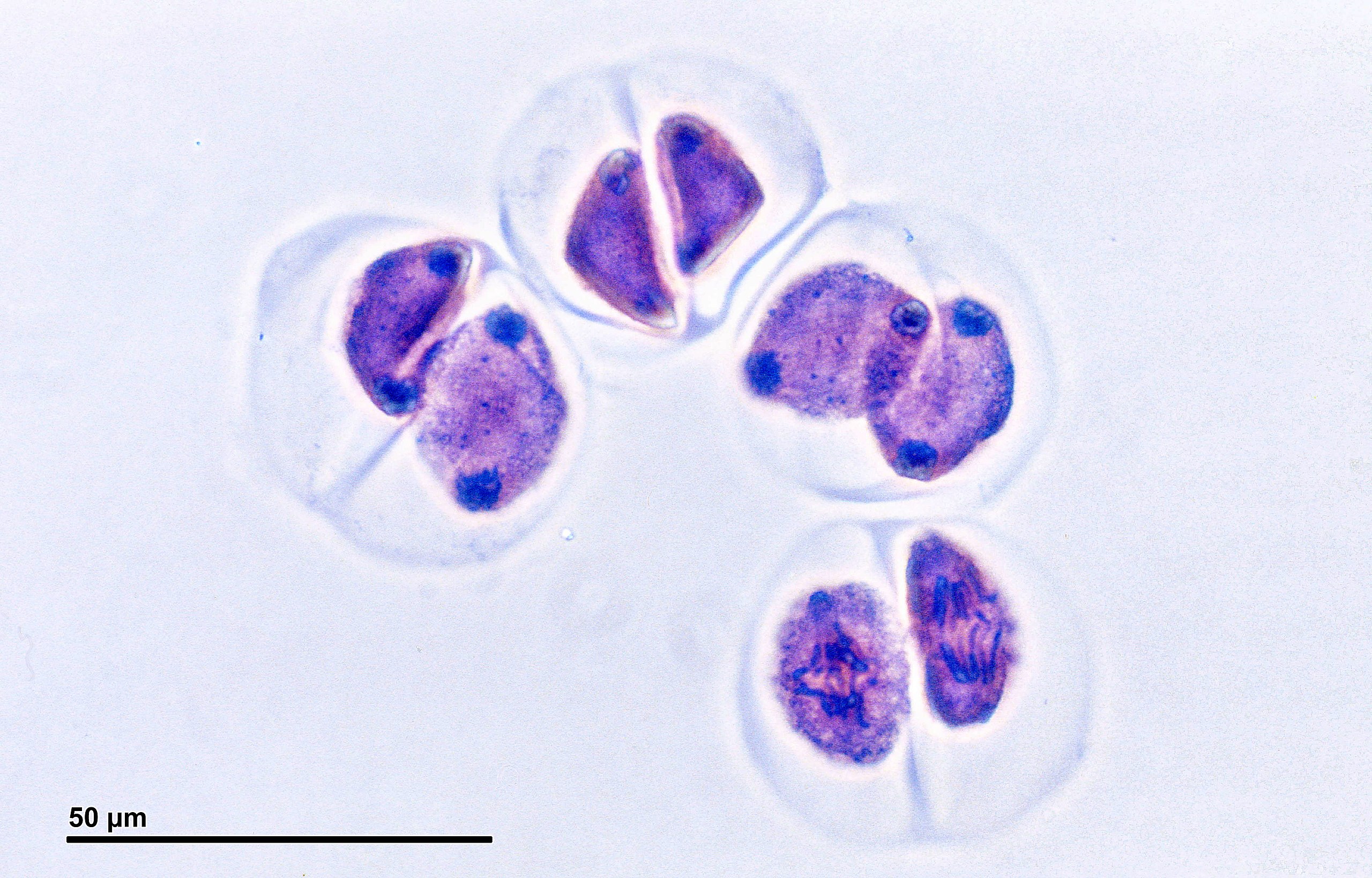 Cuatro celdas. Los tres superiores tienen cuatro regiones distintas donde los cromosomas se han agrupado.