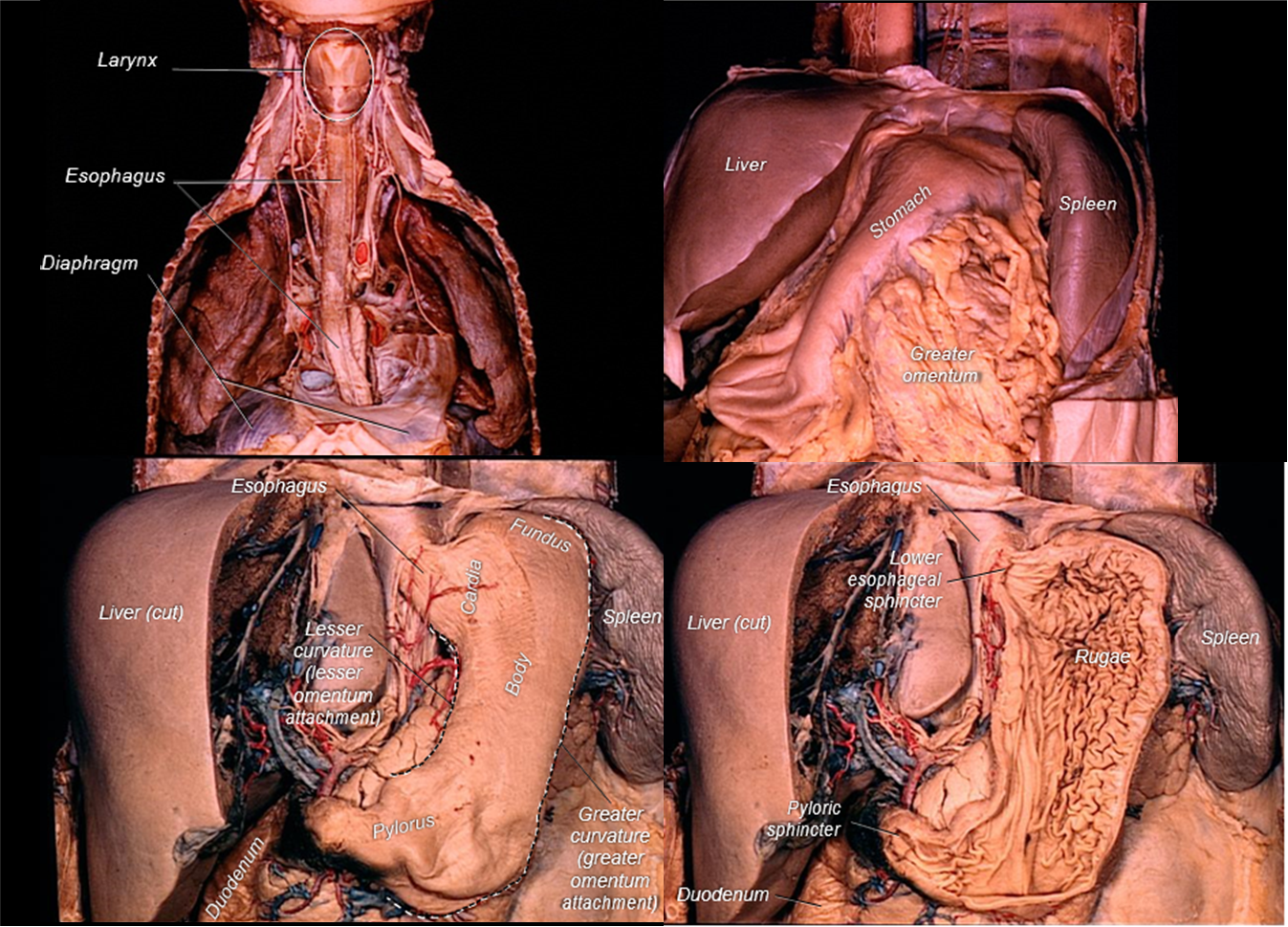 Cadaver images of stomach and esophagus