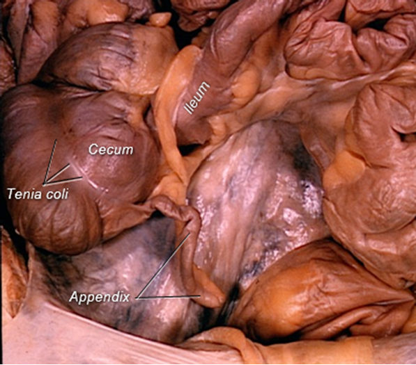 Cadaver image of the appendix