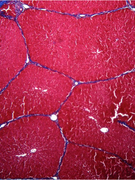 Liver tissue image for labeling.