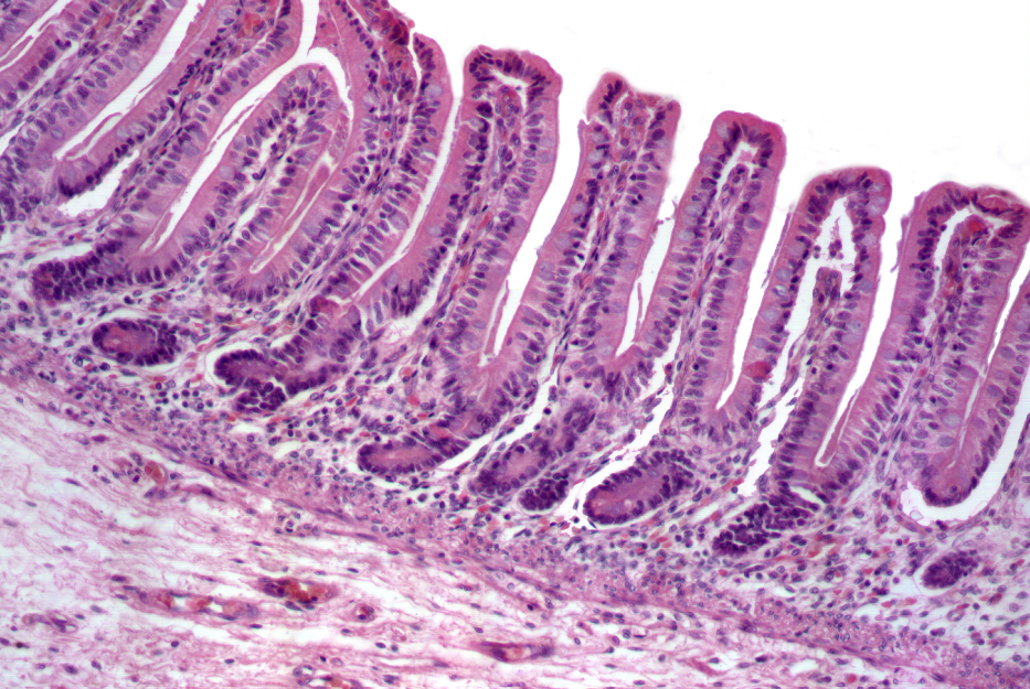Tissue lining the inside of the large intestine for labeling.