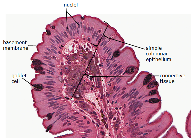 Microscopic image shows simple columnar epithelium.