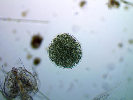 A single Nostoc colony viewed through the microscope. A transparent orb filled with chains of green cells tangled into a ball. 