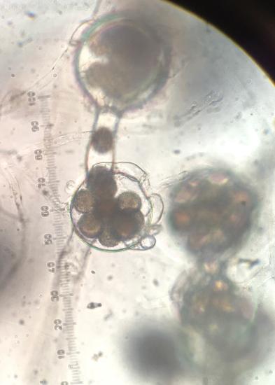 Antheridia attached to an oogonium, fertilizing the eggs with the nuclei