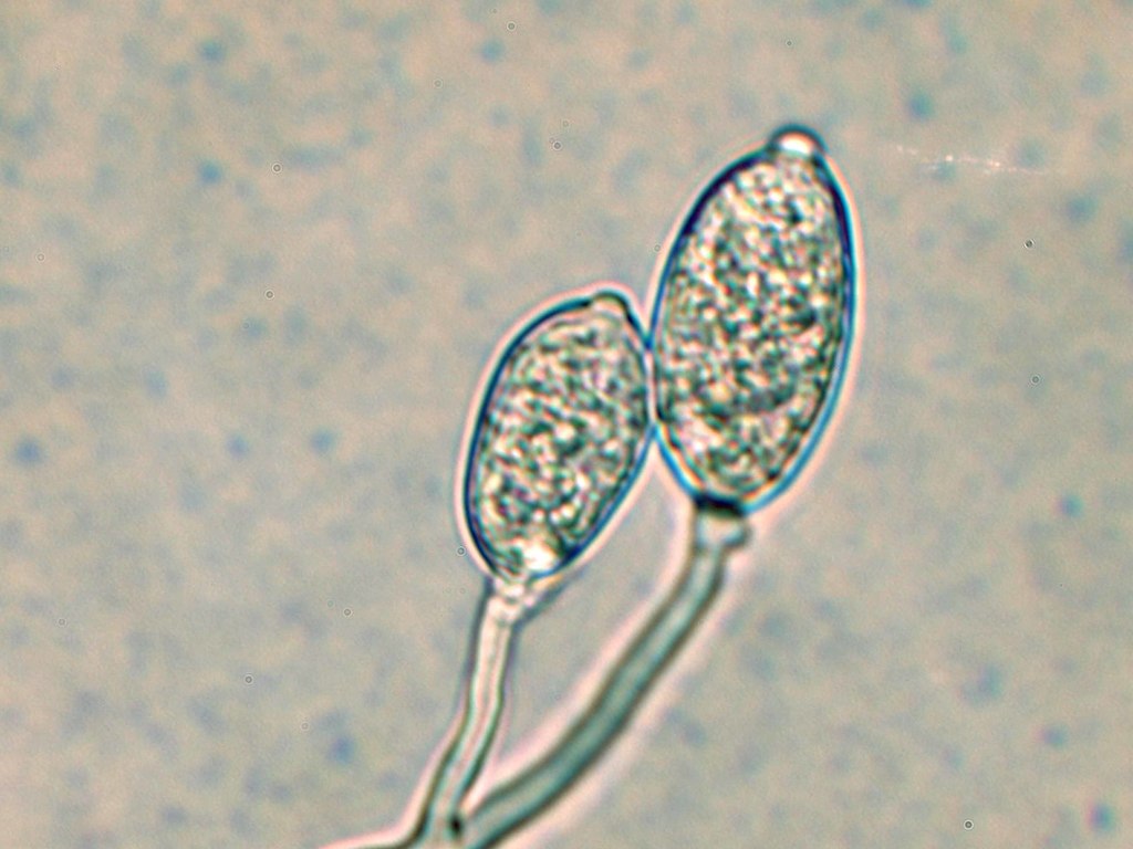 two lemon-shaped zoosporangia at the end of hyphal filaments