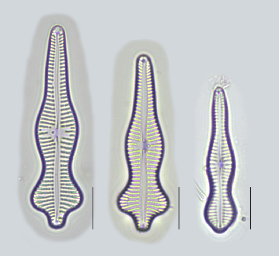 Images of three pennate diatoms next to each other. Only one line of symmetry can be drawn, directly down the center (much like a human body). 