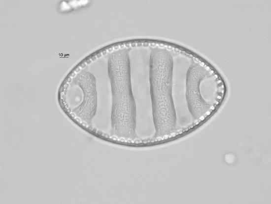 A single (American) football-shaped diatom. Only one line of symmetry can be drawn through this diatom (with three dimensional considerations). 