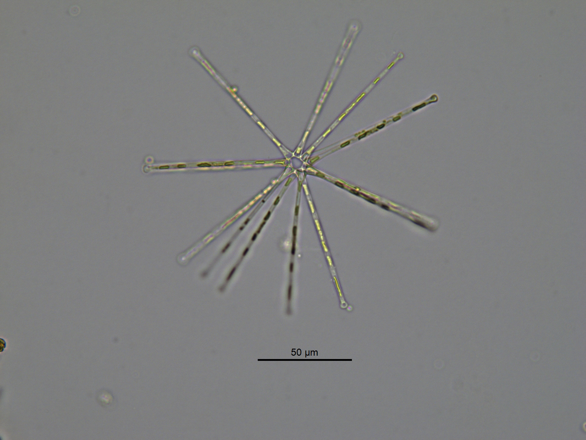 A colony of long, thin diatoms forming a three dimensional star shape