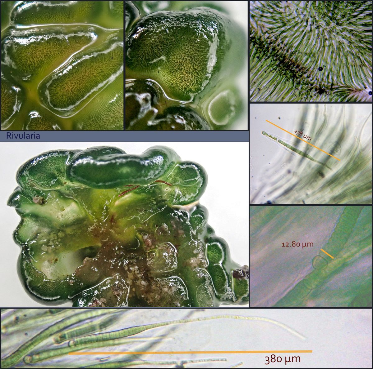 Collage de imágenes que muestran múltiples vistas de la cianobacteria Rivularia.