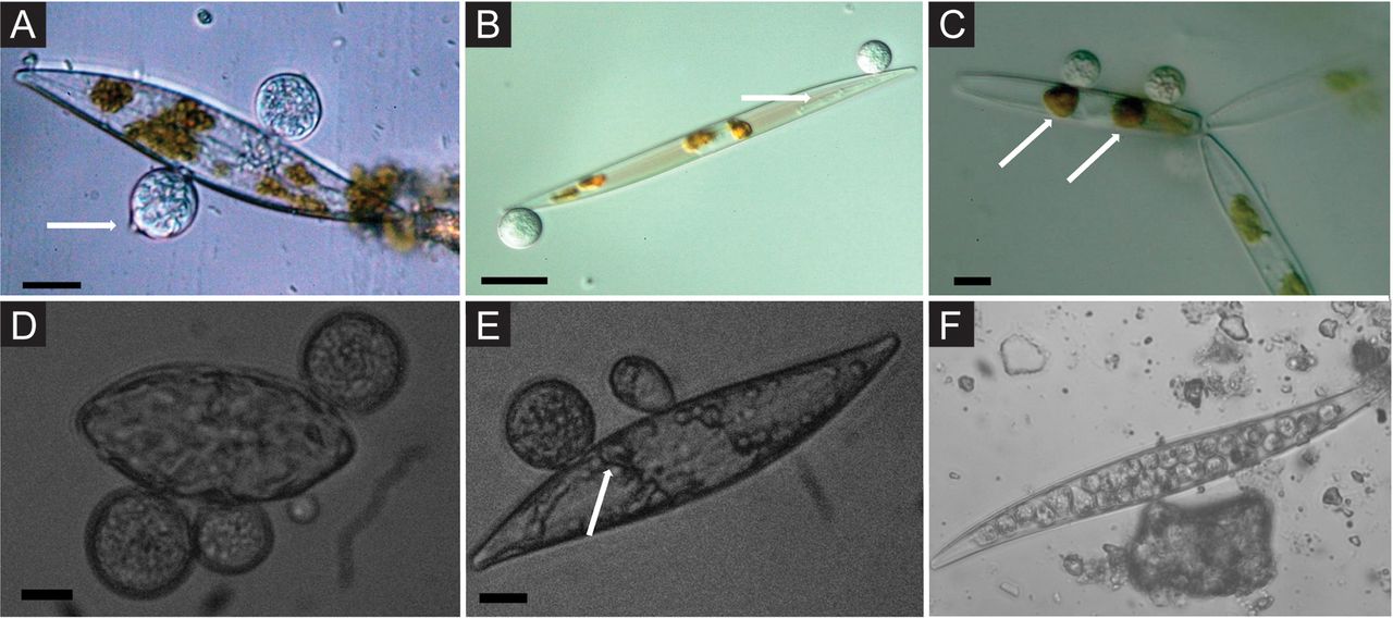 Recopilación de 6 imágenes, A-F, cada una con una diatomeas parasitada por un quítrido (estructuras grandes, globosas unidas a frustulas)