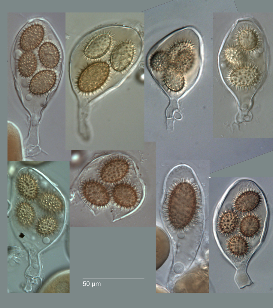 Multiple, bag-like asci. Each contains 3-4 huge, spiky spores. 