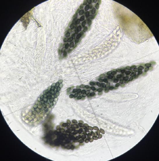 Asci from the perithecium in the previous picture. Each large ascus contains 20+ ascospores.