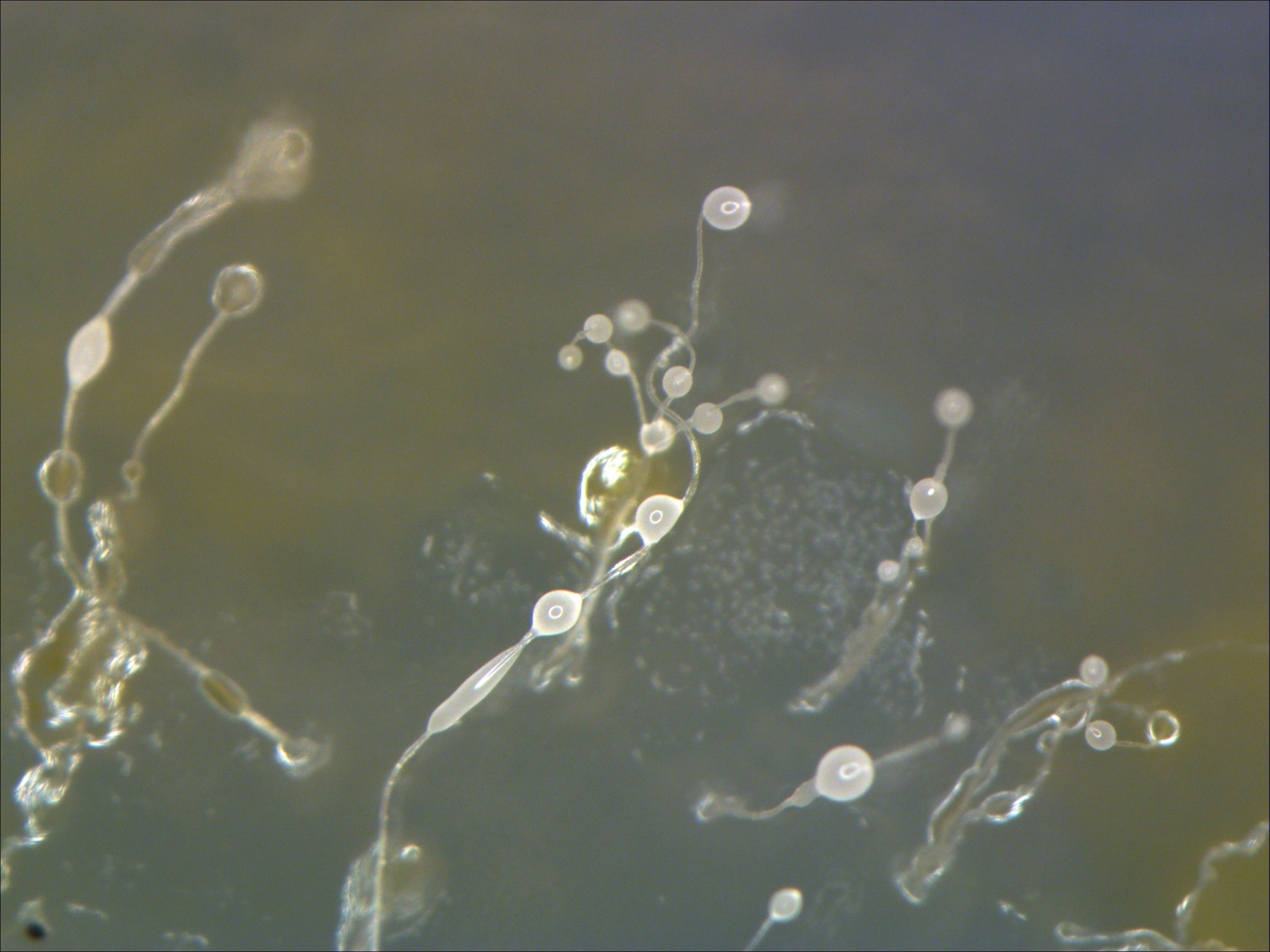 plasmodial slime molds under microscope