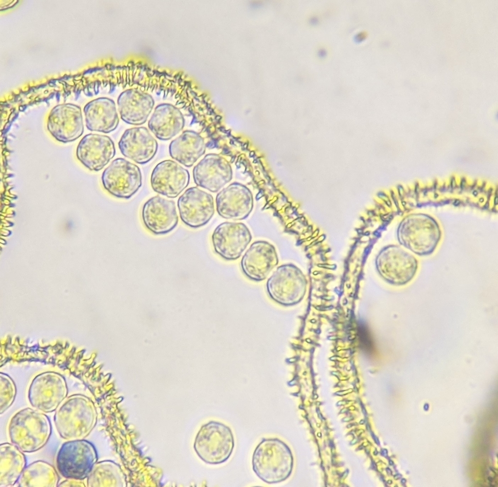 Vista microscópica de hilos capilares ornamentados (como espinas de mora) y esporas