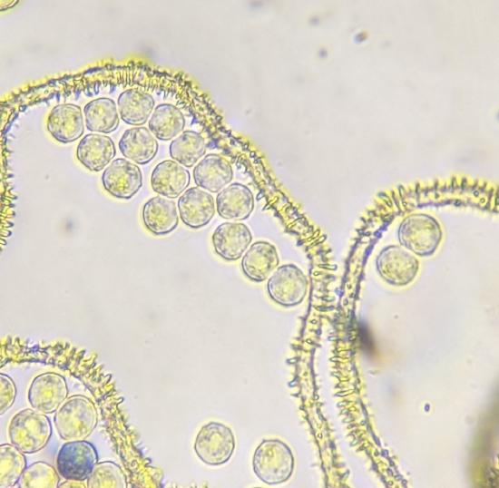 Microscopic view of ornamented capillitial threads (like blackberry prickles) and spores