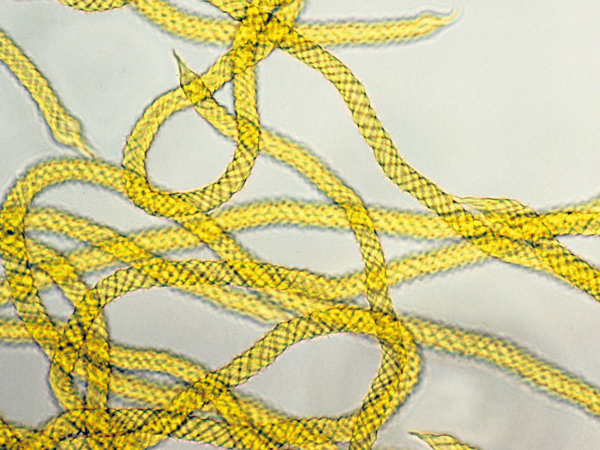 Hilos capilares de color amarillo brillante con patrón retorcido, vistos bajo el microscopio