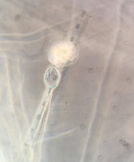 A similar-looking sporagium, but it is empty. The former contents (zoospores) are above it in an amorphous mass. 