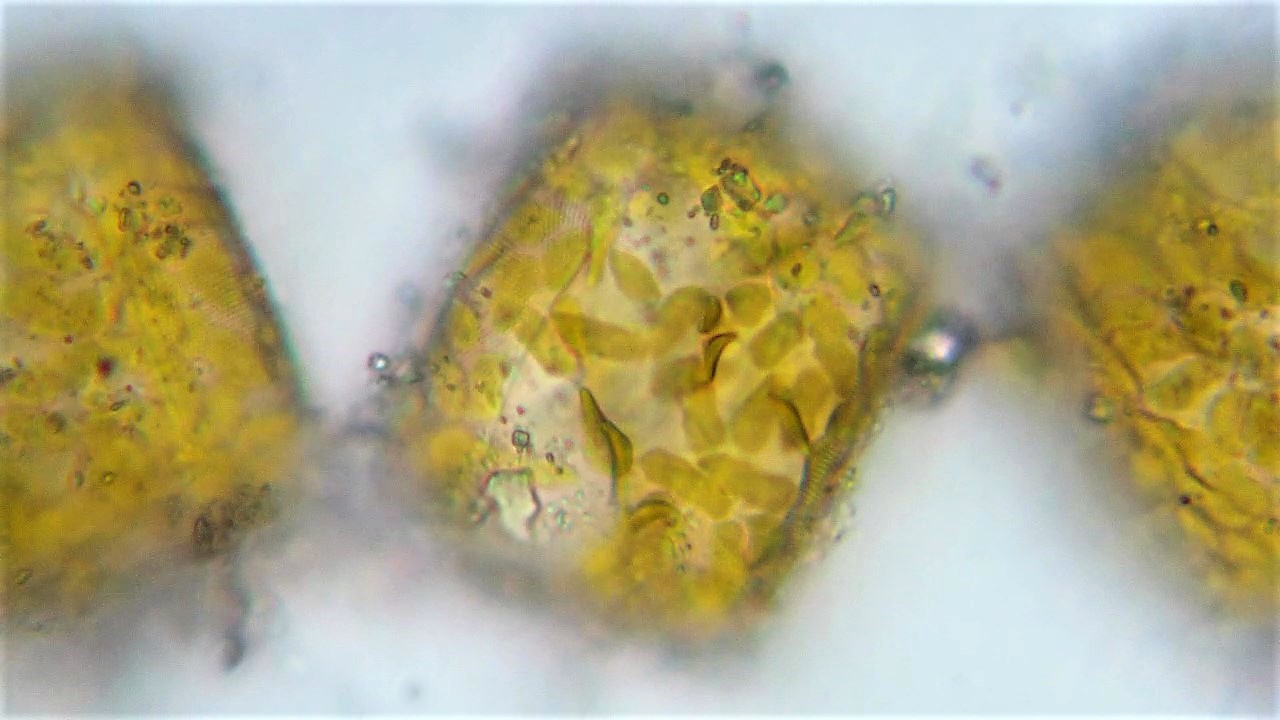 Una diatomea céntrica, aproximadamente cuadrada, llena de discos amarillos (cloroplastos)