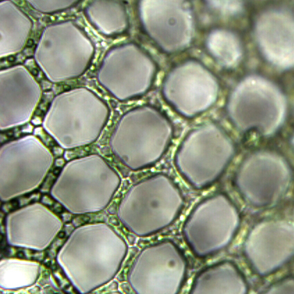 A network formed by individual green algal cells. They link together to form a net-like structure.