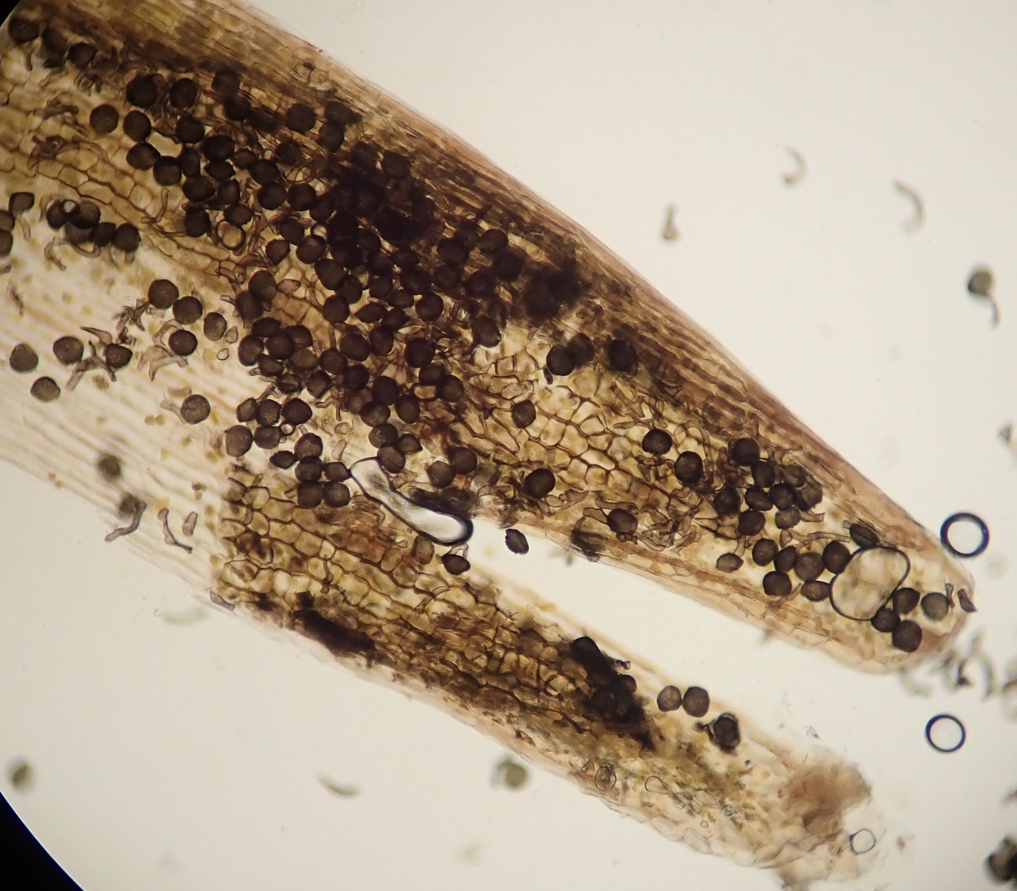 Una vista a través de un microscopio de la punta de un esporófito, muchas estructuras globosas oscuras (esporas) son visibles.