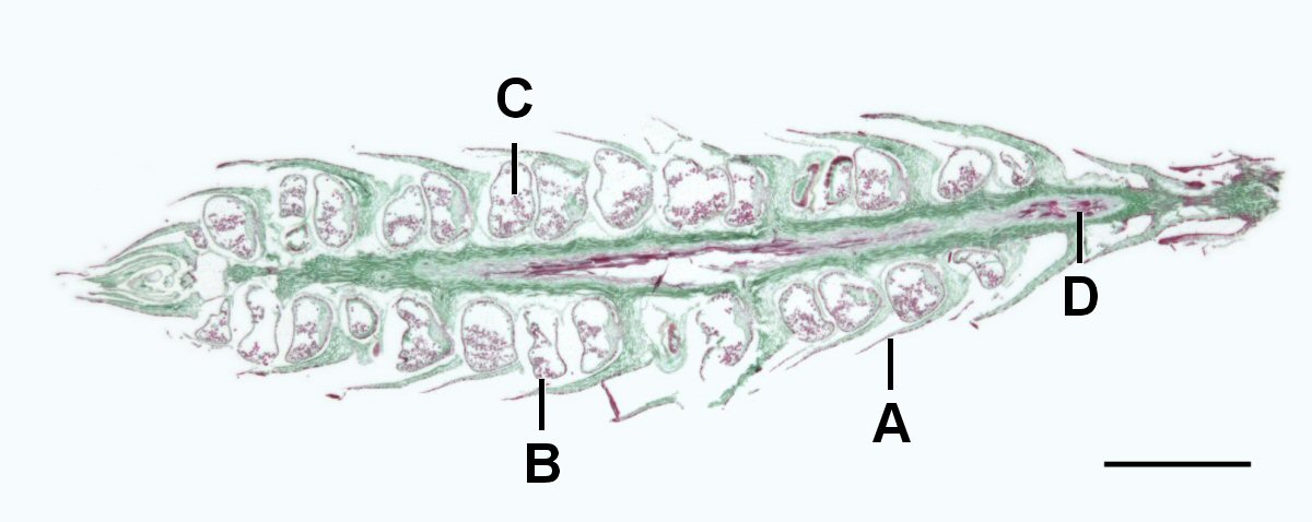 A long section of a Lycopodium strobilus.
