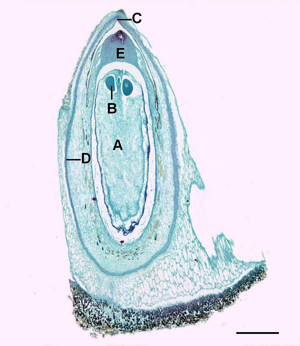 A longitudinal section through a pine ovule