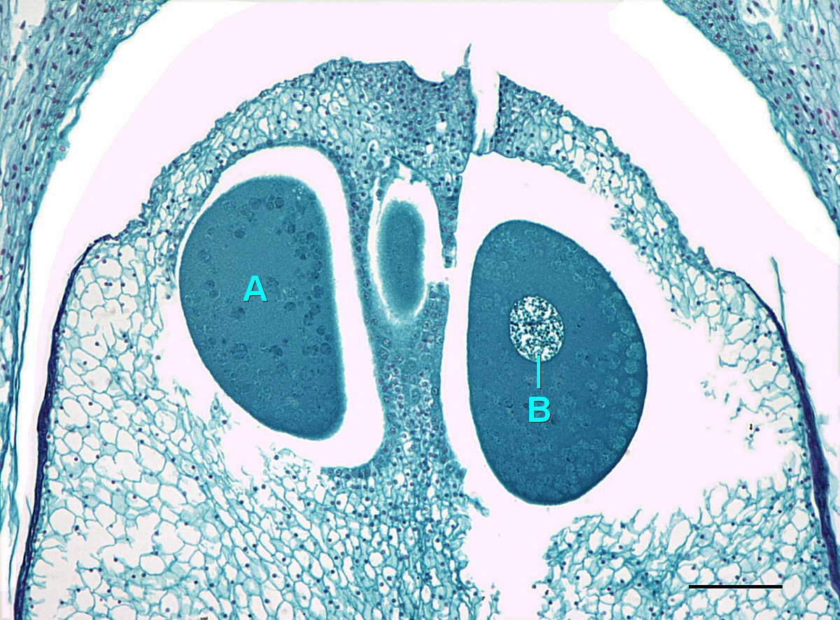 Un primer plano sobre el óvulo de pino, mostrando dos óvulos, uno de los cuales tiene un núcleo visible