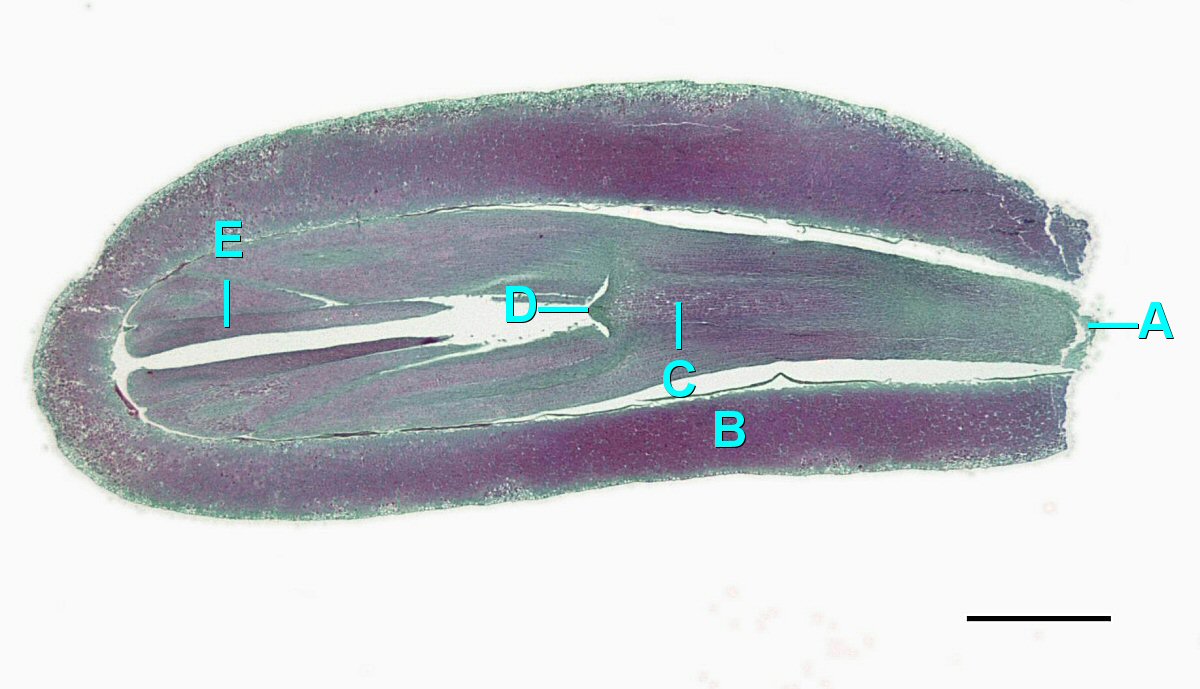 Una sección longitudinal de un embrión de pino en desarrollo dentro de la semilla. El meristemo apical del brote se localiza entre los dos cotiledones.