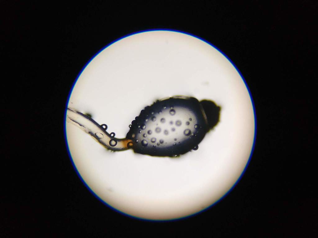 Un solo cuerpo fructífero de Pilobolus bajo el microscopio