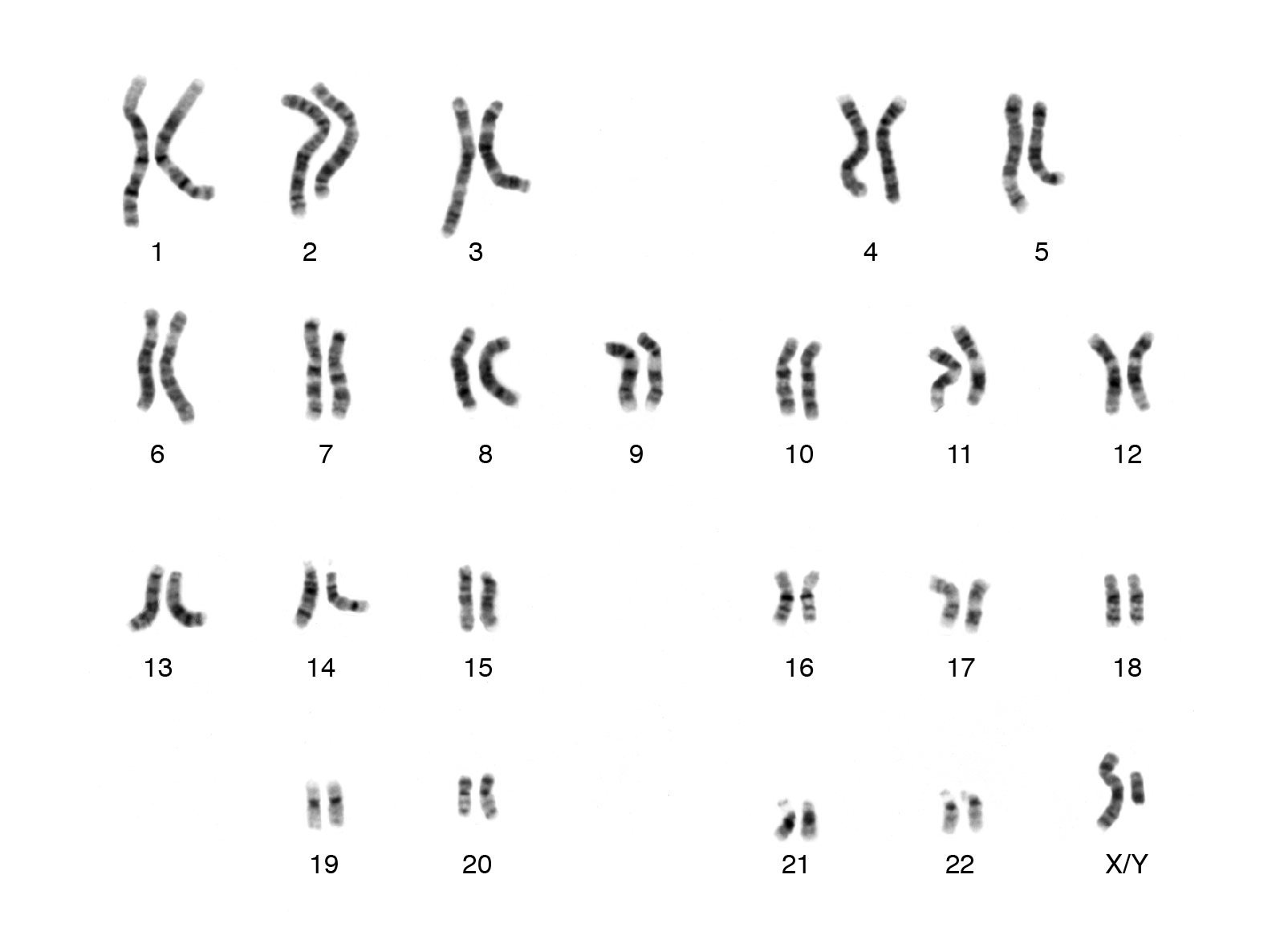 karyotype.jpg
