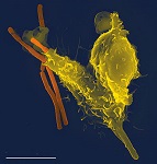 14: Cell-Mediated Immunity