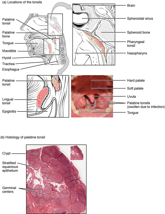 The top panel of this image shows the location of the tonsils. All the major parts are labeled. The bottom panel shows the histological micrograph of the tonsils.