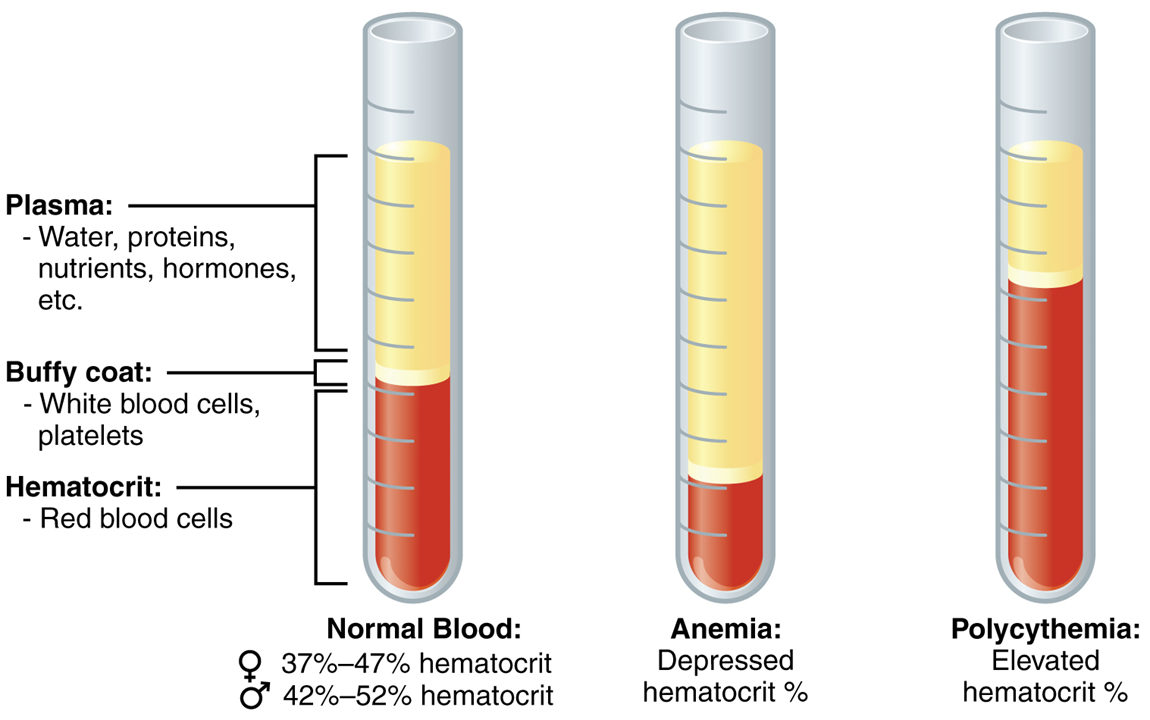 Esta figura muestra tres tubos de ensayo con un líquido rojo y amarillo en ellos. El panel izquierdo muestra sangre normal, el panel central muestra sangre anémica y el panel derecho muestra sangre policitemica.