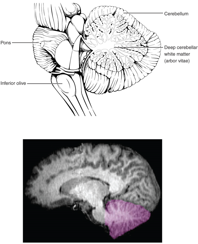 Esta figura muestra la ubicación del cerebelo en el cerebro. En el panel superior, una vista lateral etiqueta la ubicación del cerebelo y la materia blanca cerebelosa profunda. En el panel inferior se muestra una fotografía de un cerebro, con el cerebelo en color rosa.