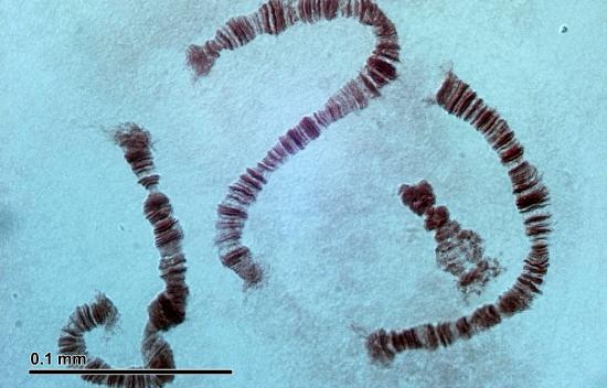 A bright-field micrograph of chromosomes shaped like short, thick strings
