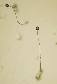 A microscopic closeup. Two heads of cellular slime mold with thin, spindly tales extending from them