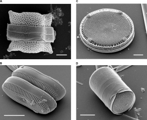 Four diatoms with varying shapes. Top right has a rectangular shape with a thicker band across it, top right is a round disk shape, bottom left is two loosely cylindrical shapes, and bottom left is a cylinder.