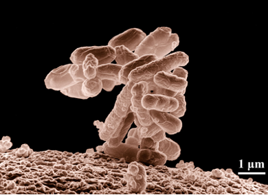 A microscopic recreation of a bacteria, the cells conglomerate in a tower that leans toward the left