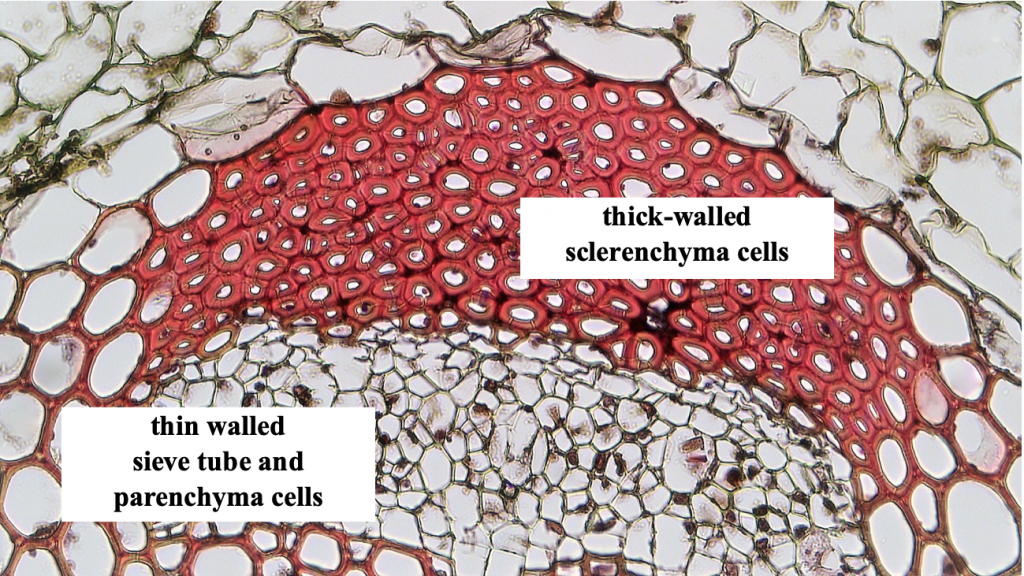 cross sections of stem tissue showing a variety of cell types including thin walled sieve tube and parenchyma cells and thick-walled sclerenchyma cells
